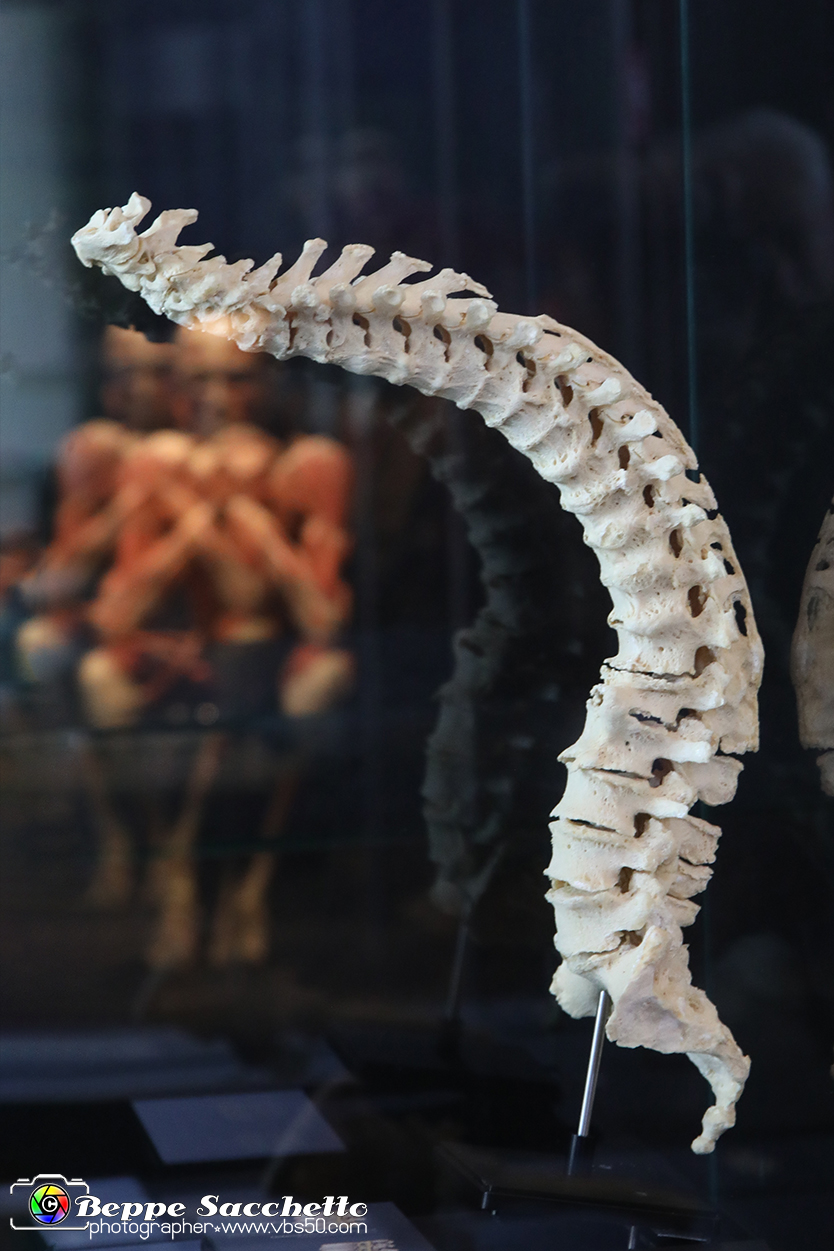 VBS_3052 - Degenerazione della colonna vertebrale. Spondilosi - Mostra Body Worlds.jpg